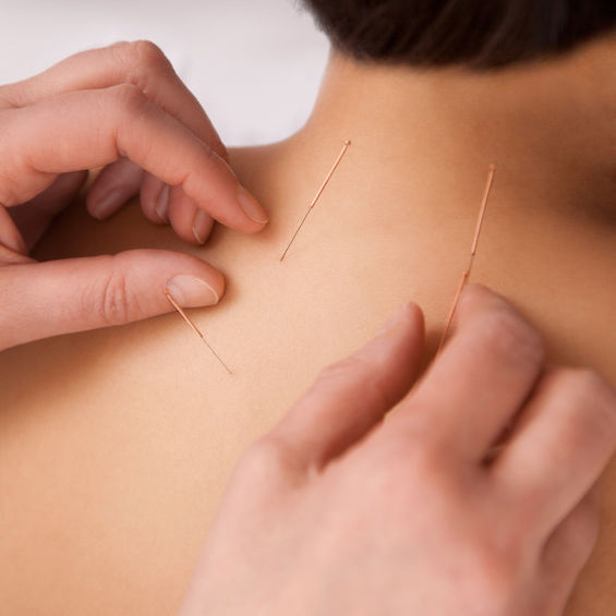 Barrhaven Chinese Acupuncture Clinic